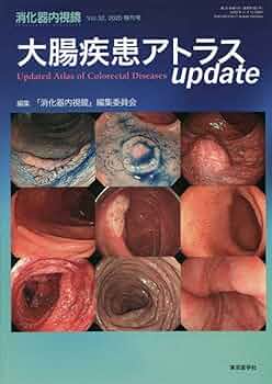 消化器内視鏡 (Vol.30 (2018 増刊号)) 02221300.jpg